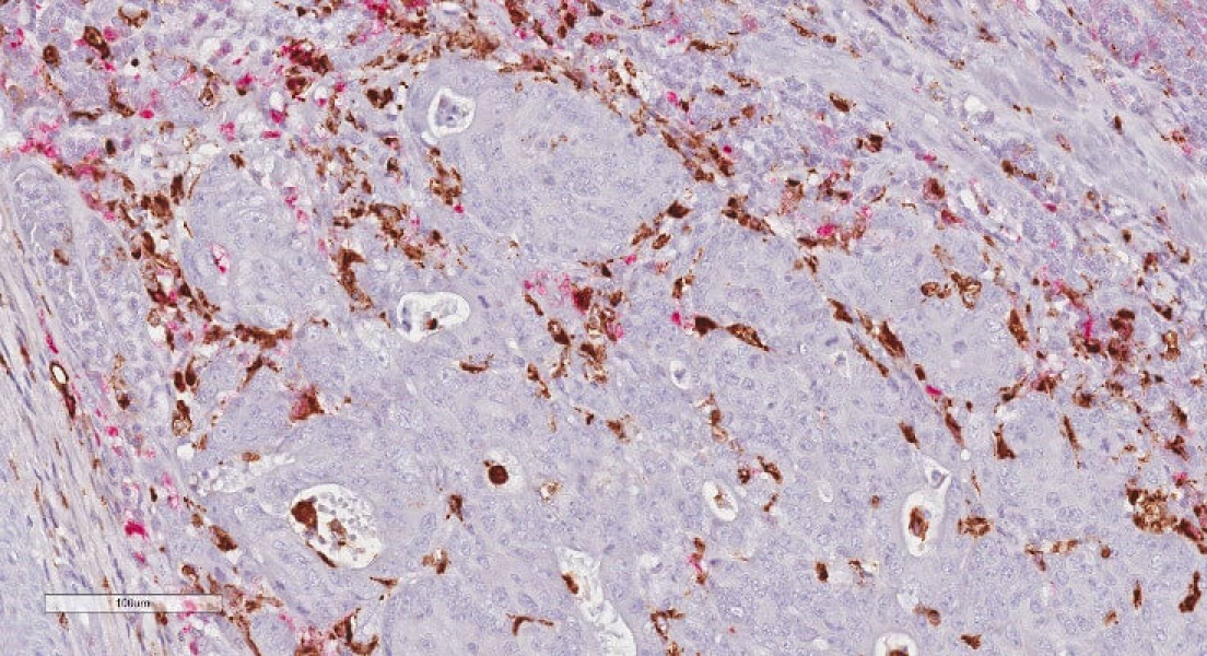 Link to /sites/default/files/styles/slider_desktop/public/images/slide/cd-68-red.jpg?itok=b9xU1CUK