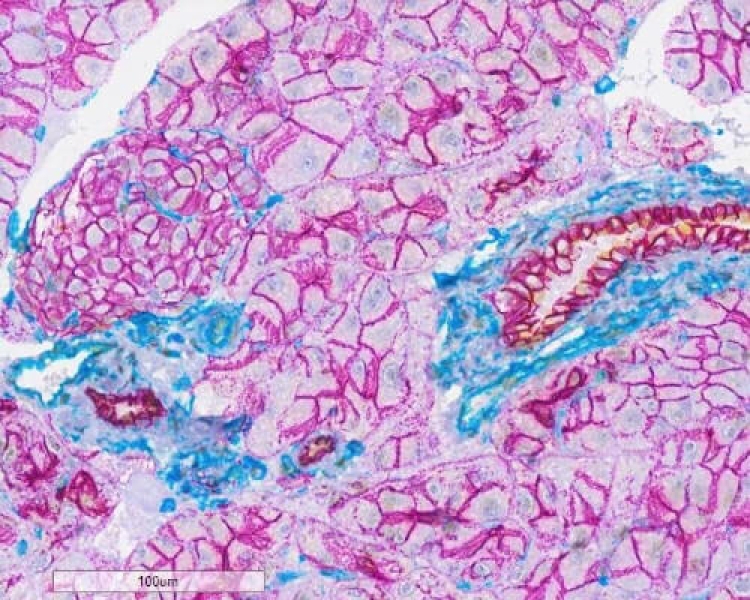 Link to /sites/default/files/styles/slider_desktop/public/images/slide/e-cadherin-purple-teal.jpg?itok=7C3Su3Y5