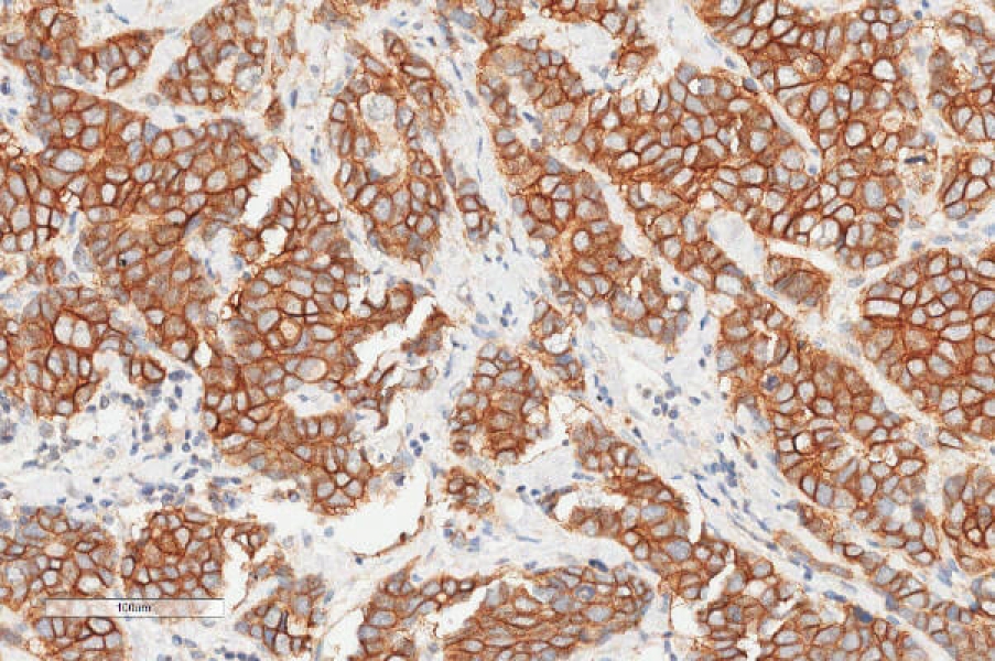 Link to /sites/default/files/styles/slider_desktop/public/images/slide/ihc-staining-her-2.jpg?itok=1_lFfpUs