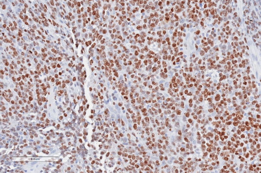 Link to /sites/default/files/styles/slider_desktop/public/images/slide/ihc-staining-ki-67.jpg?itok=K3RRqmoZ