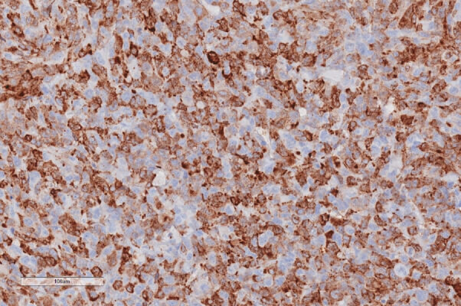 Link to /sites/default/files/styles/slider_desktop/public/images/slide/ihc-staining-ps6.jpg?itok=AGkOMpyH