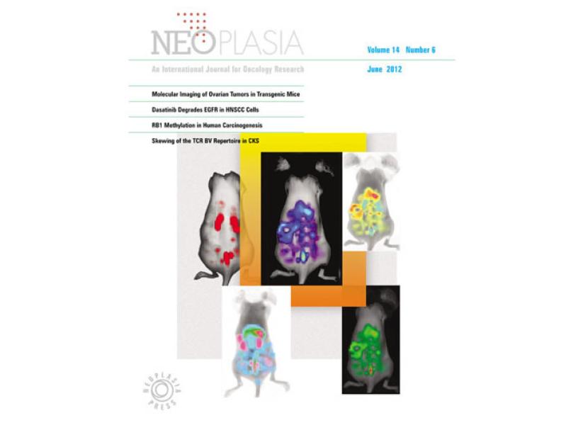 Link to /sites/default/files/styles/slider_desktop/public/images/slide/neoplasia-cover_large_0.jpg?itok=tgLccgbk