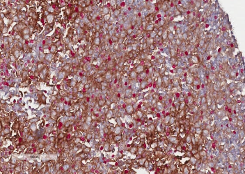 Link to /sites/default/files/styles/slider_desktop/public/images/slide/pd-l1-brown-red.jpg?itok=aghzv7FG