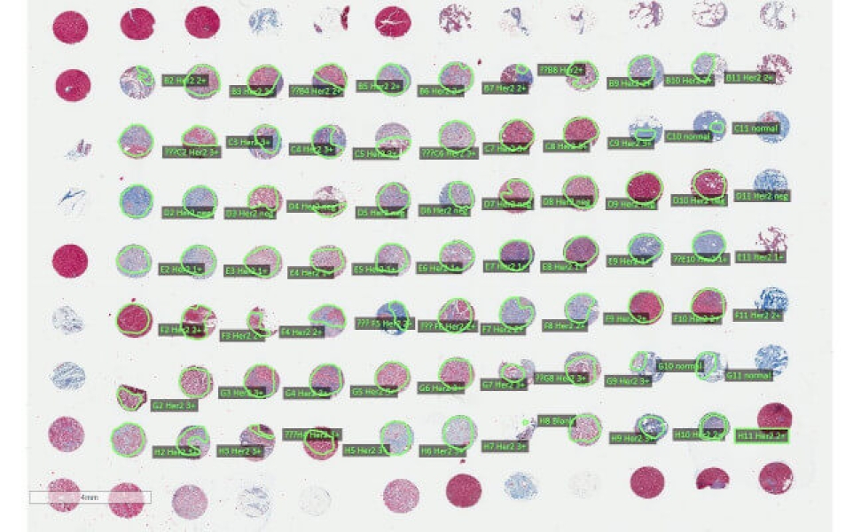 Link to /sites/default/files/styles/slider_desktop/public/images/slide/quantitative-image-analysis-collagen-staining.jpg?itok=xY4afjsg