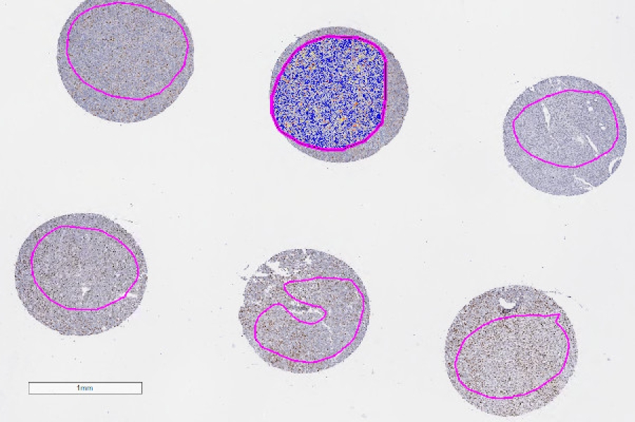 Link to /sites/default/files/styles/slider_desktop/public/images/slide/quantitative-image-analysis-ki-67-staining.jpg?itok=Lb2JhqSl