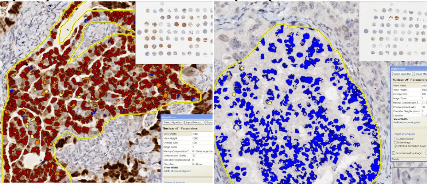 Link to /sites/default/files/styles/slider_desktop/public/images/slide/quantitative-image-analysis-nuclear%20%281%29.jpg?itok=Ba7_qNoN