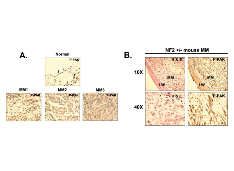 Immunohistochemical staining for phosphorylated PAK