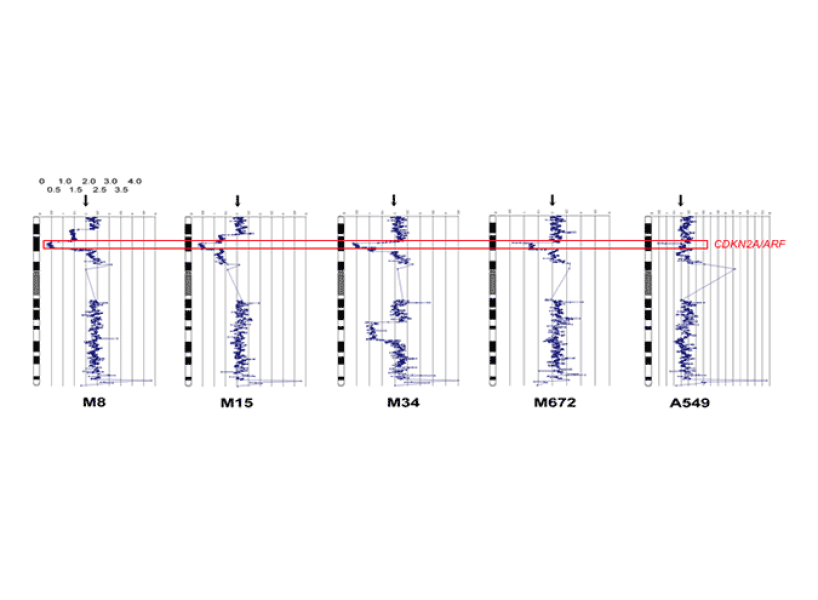 Homozygous losses of the CDKN2A/ARF locus in human mesothelioma