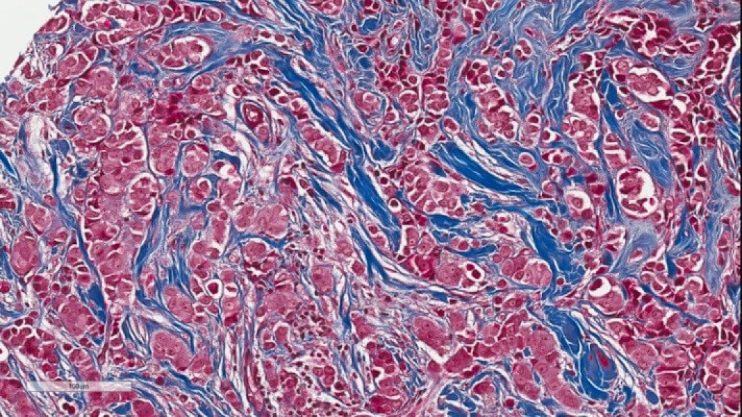 Link to /sites/default/files/styles/slider_desktop/public/images/slide/trichrome-staining-breast-cancer.jpg?itok=M6mHwUrJ