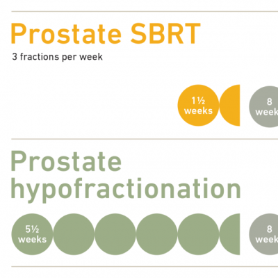 Conventional fractionated and moderate hypofractionated radiation therapy for localized prostate cancer were equally effective.