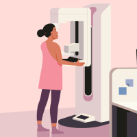 Mammography Guidelines Updated