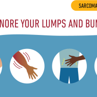 Link to /sites/default/files/styles/thumb/public/21FC080-FCCC-Sarcoma-Infographic-1200x630-a-F_0.png?h=ec041e41&itok=rJ-72lv8