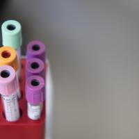 A blurred photograph of six labelled vials of various sizes and lid colors in a red holder.