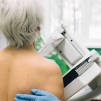 A photograph from behind a person receiving a mammogram, with a gloved hand on their back.