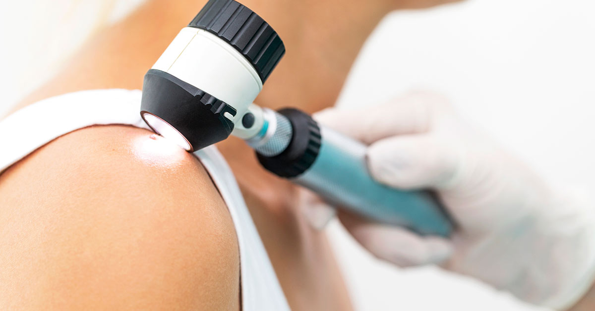 A close up photograph of a medical professional using a handheld tool to example a small lump on a patient's shoulder.